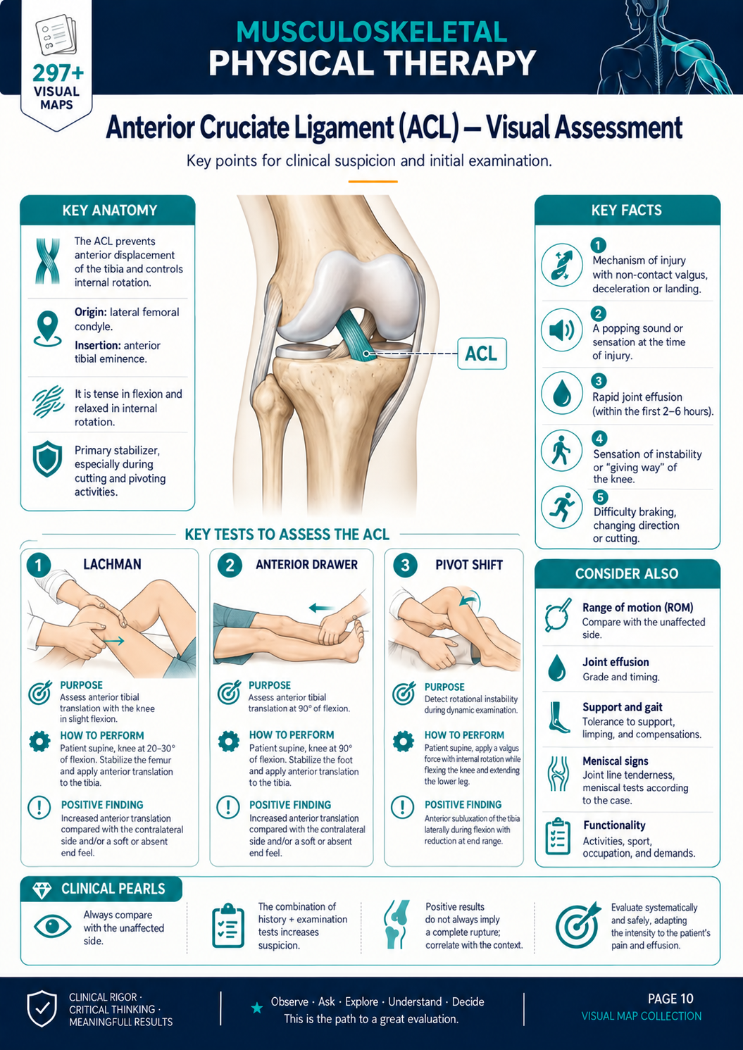 Anterior Cruciate Ligament visual map in English